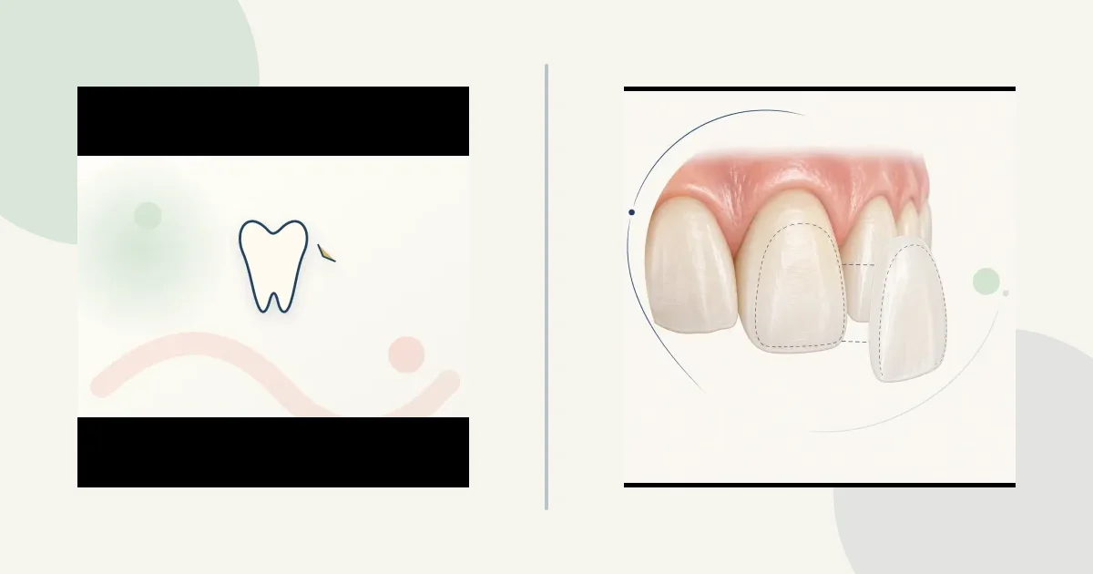 Removable cosmetic arch vs fixed comparison graphic