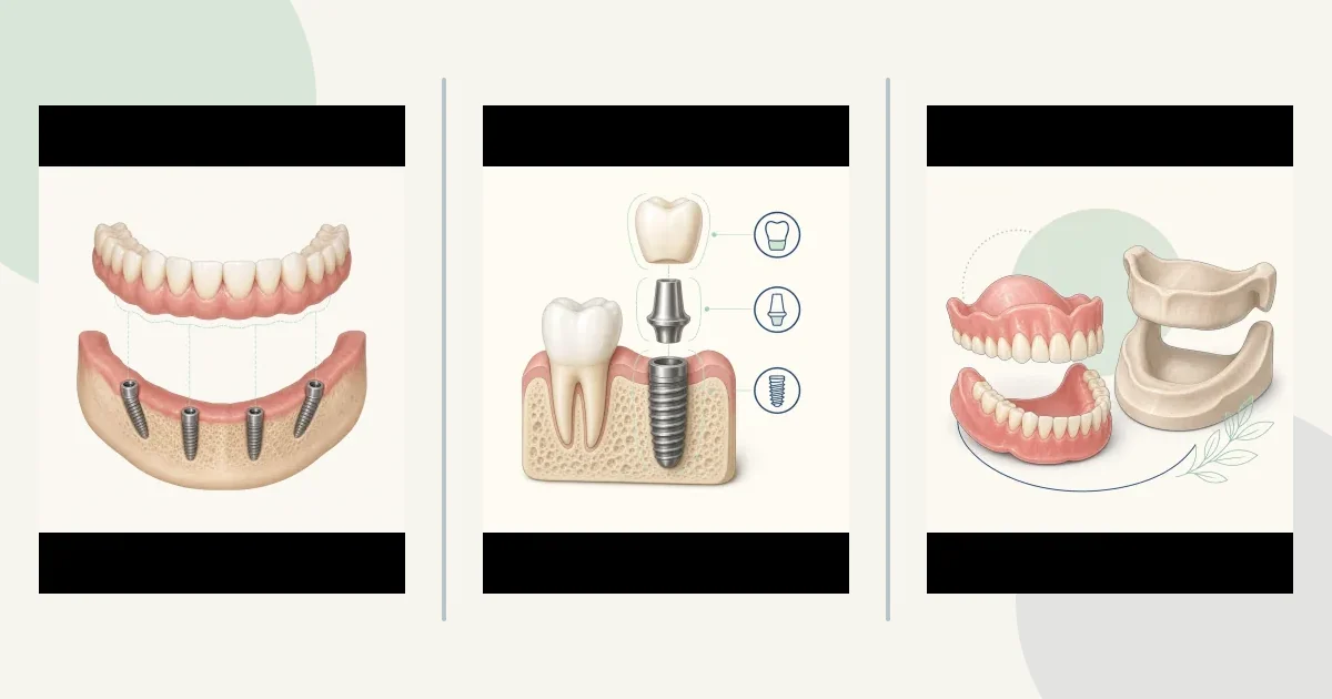 Failing-dentition master page comparison graphic