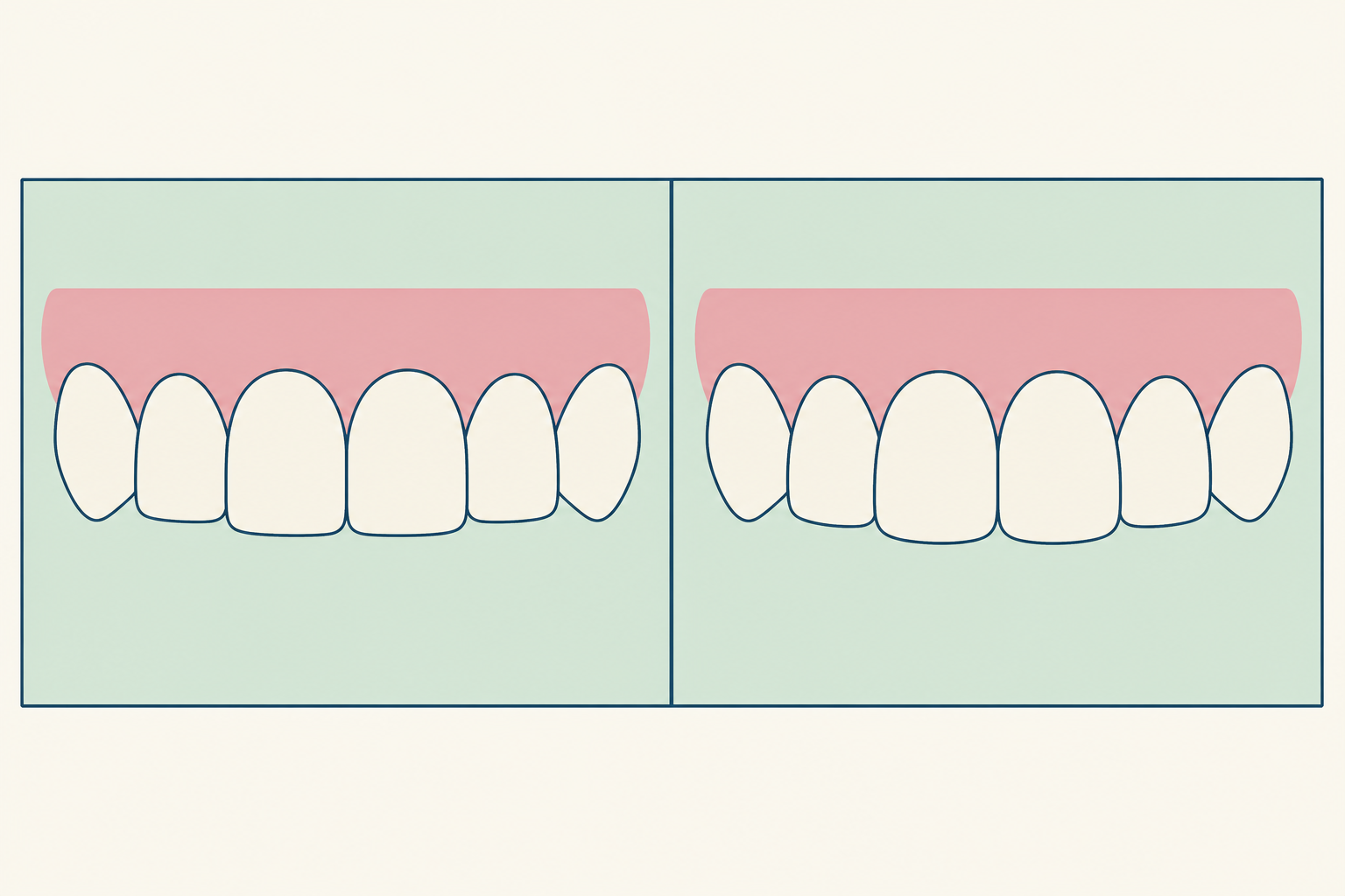 Illustrative diagram: veneers in cairo vs dubai