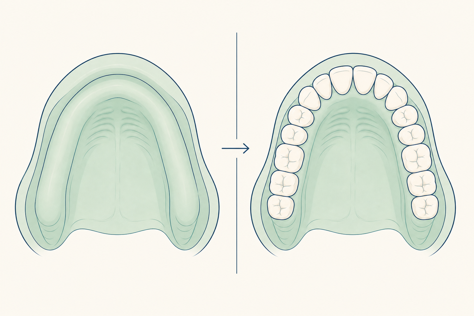 Illustrative diagram: Anodontia