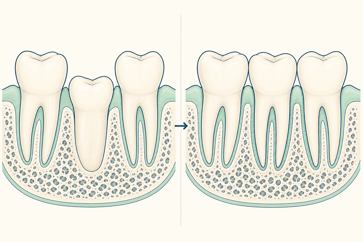 Illustrative diagram: Dental Ankylosis