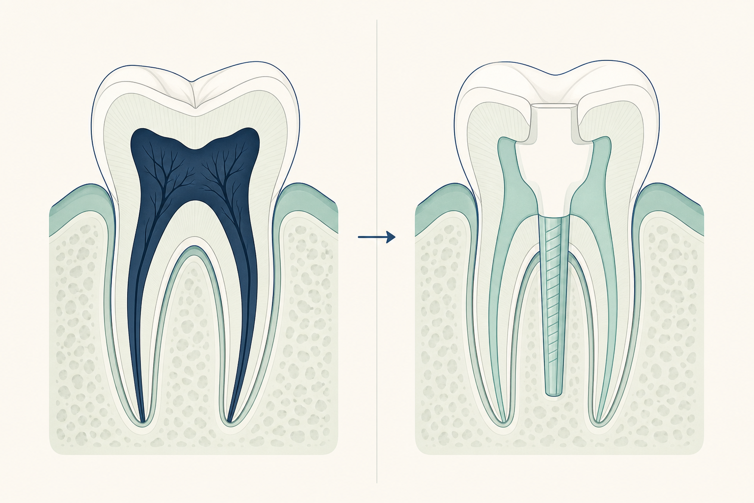 Illustrative diagram: Post & Core