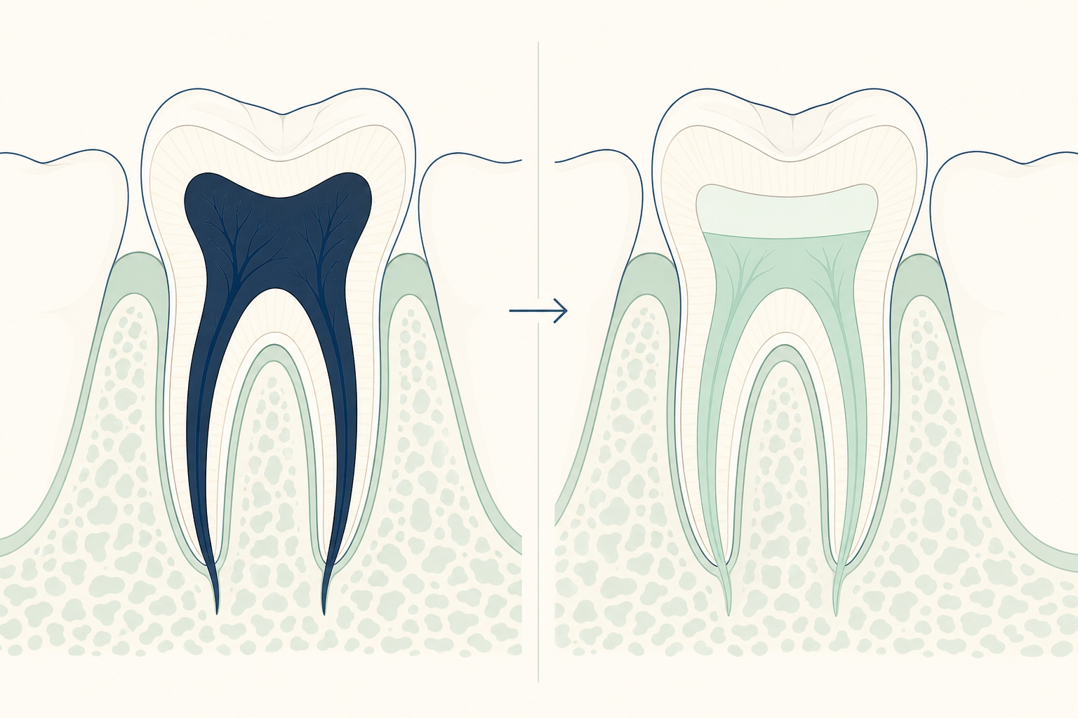 Illustrative diagram: Regenerative Endodontics