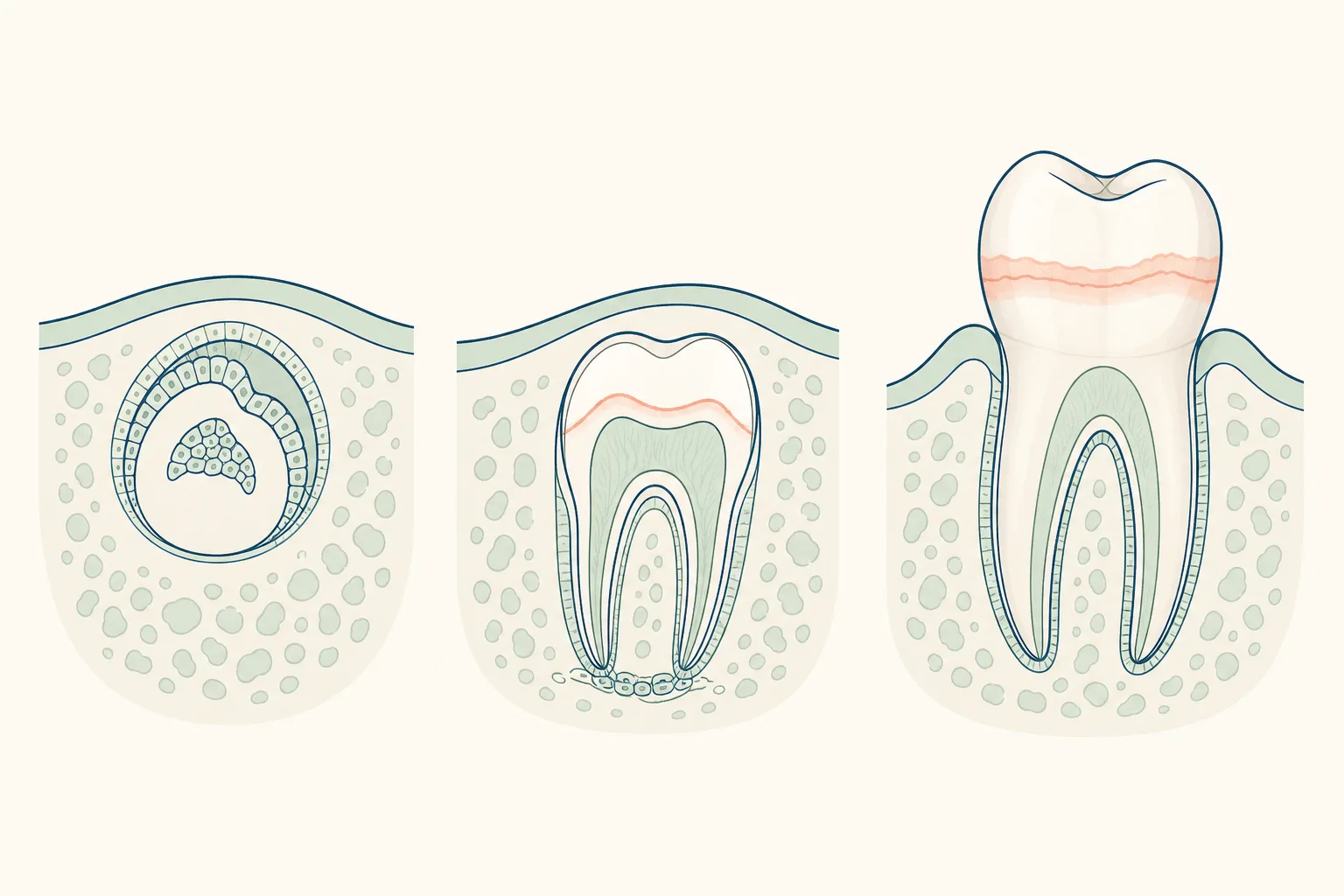Tooth Formation Disturbance dental educational illustration