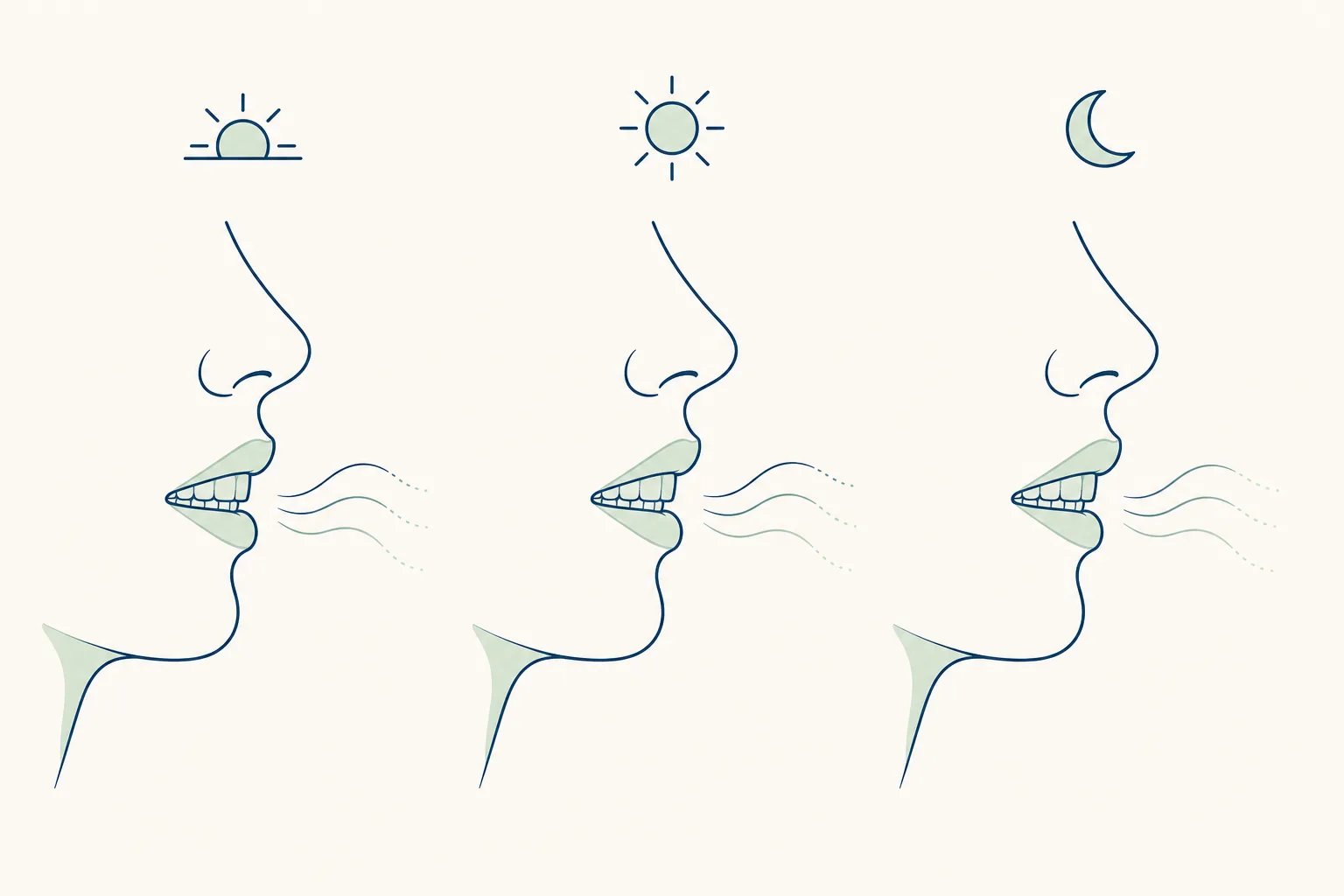 Chronic Halitosis (Medical) dental educational illustration