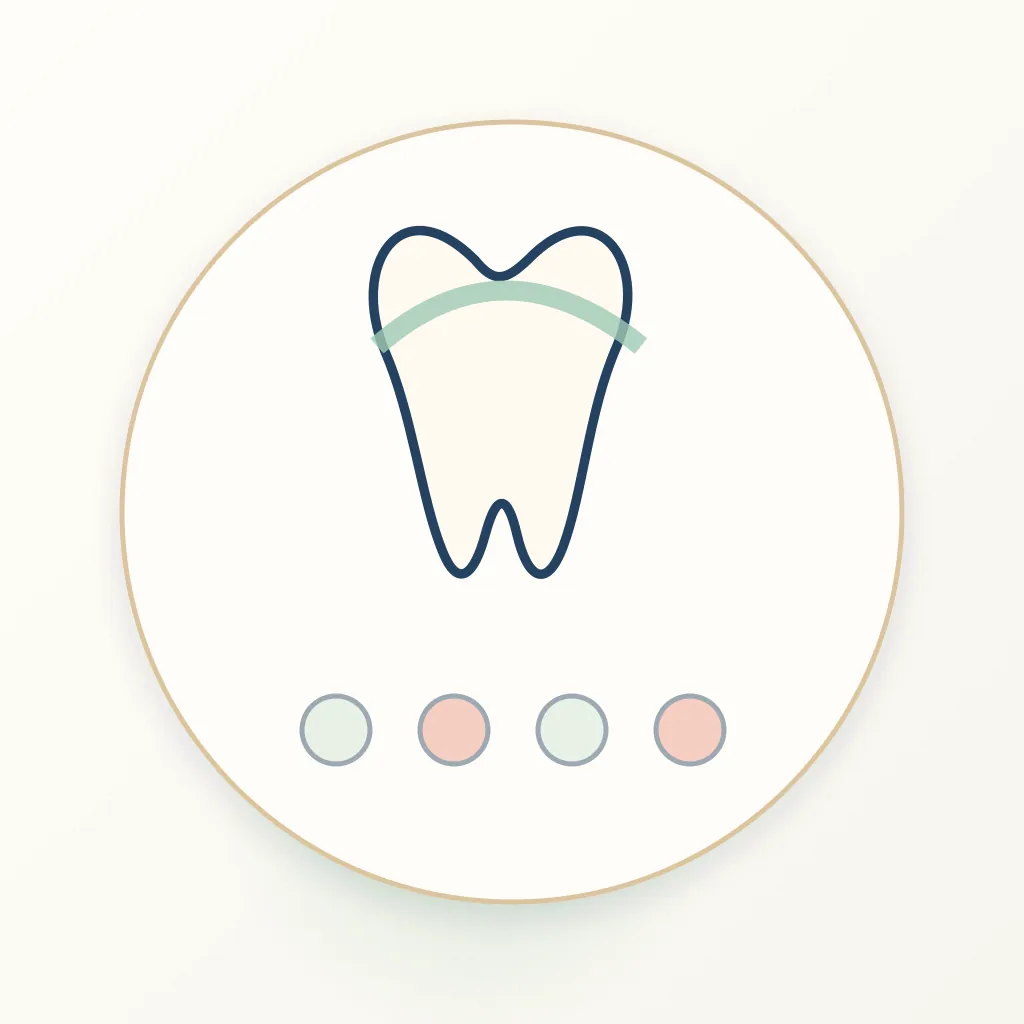 Hybrid Ceramic dental educational illustration