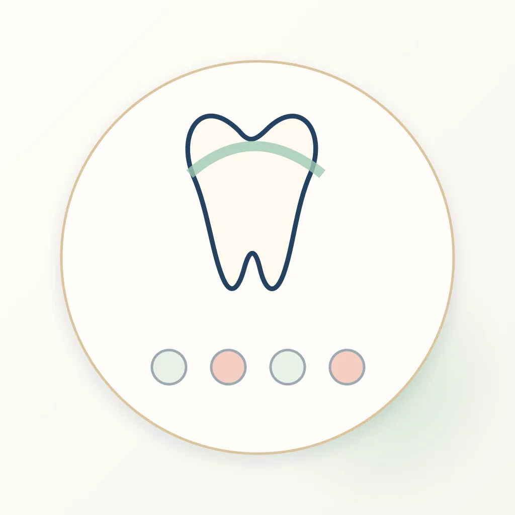 e.max (Lithium Disilicate) dental educational illustration