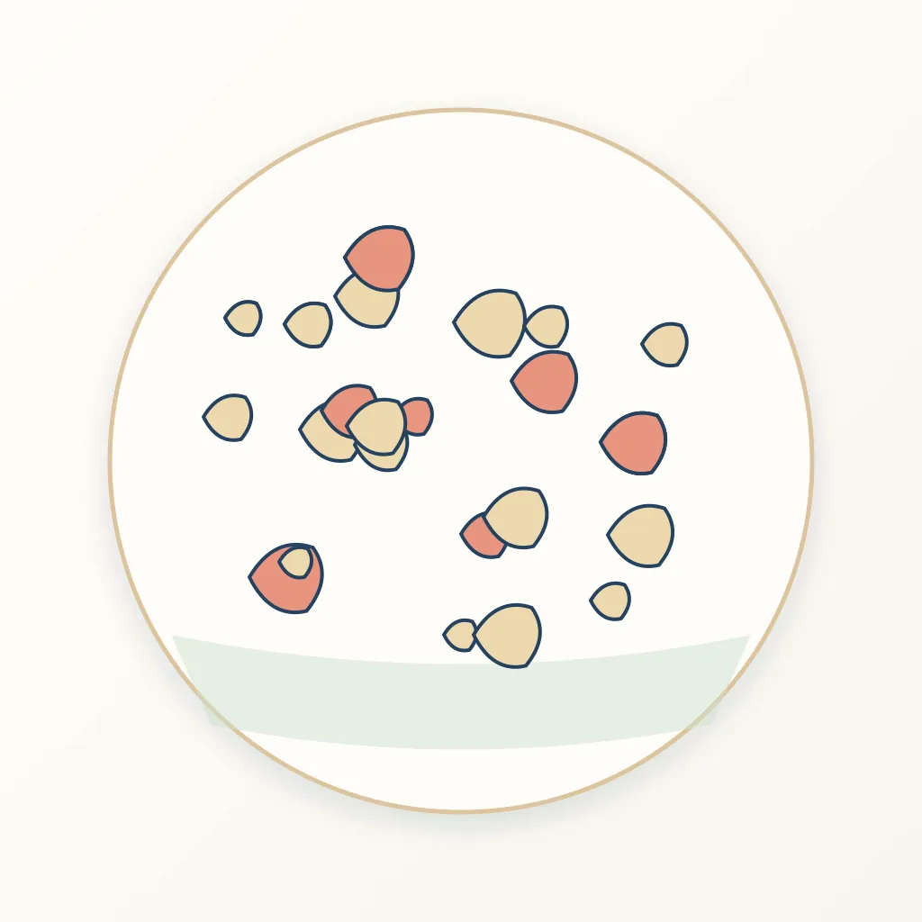 Hydroxyapatite & Bone-Graft Substitutes dental educational illustration