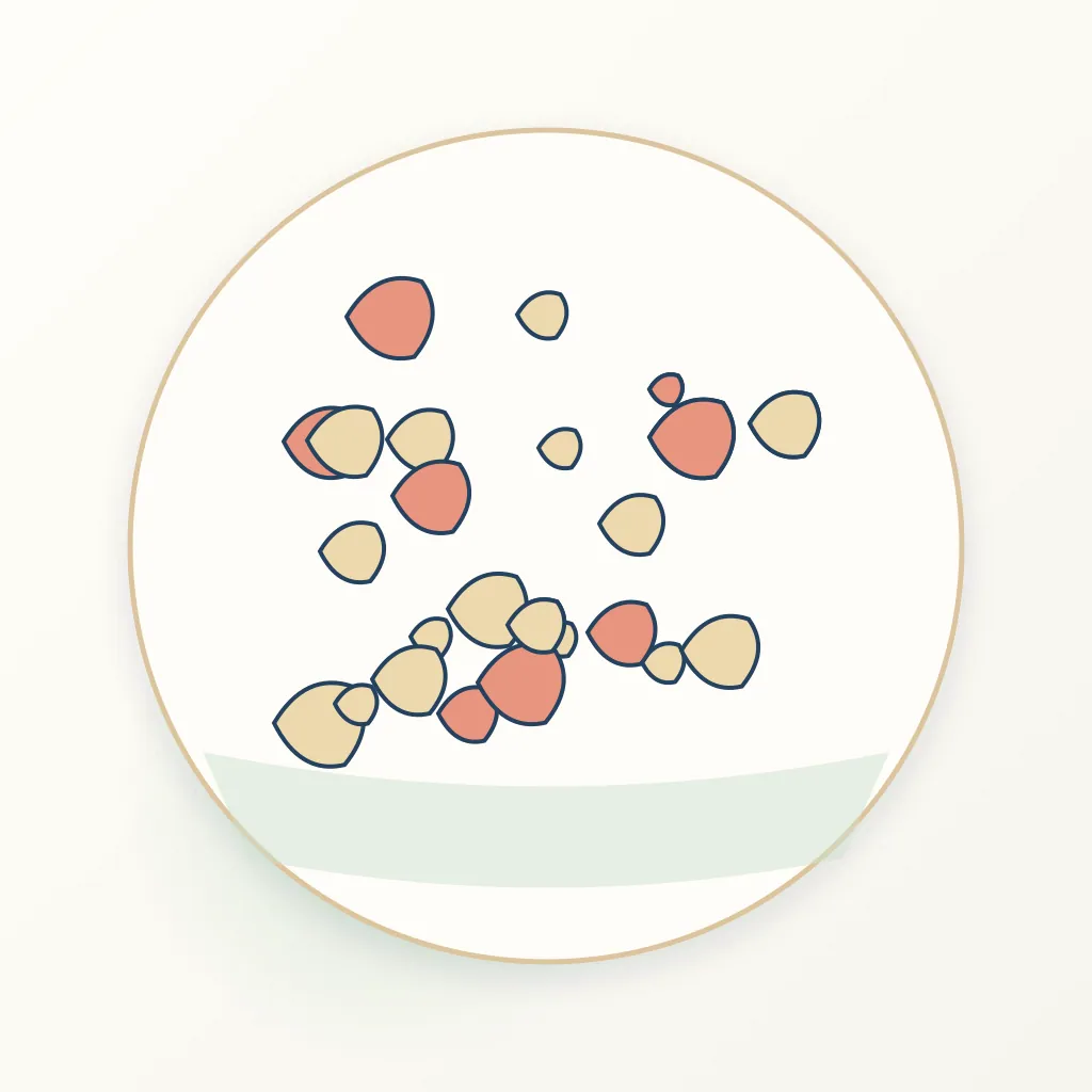 Autogenous Bone Graft dental educational illustration