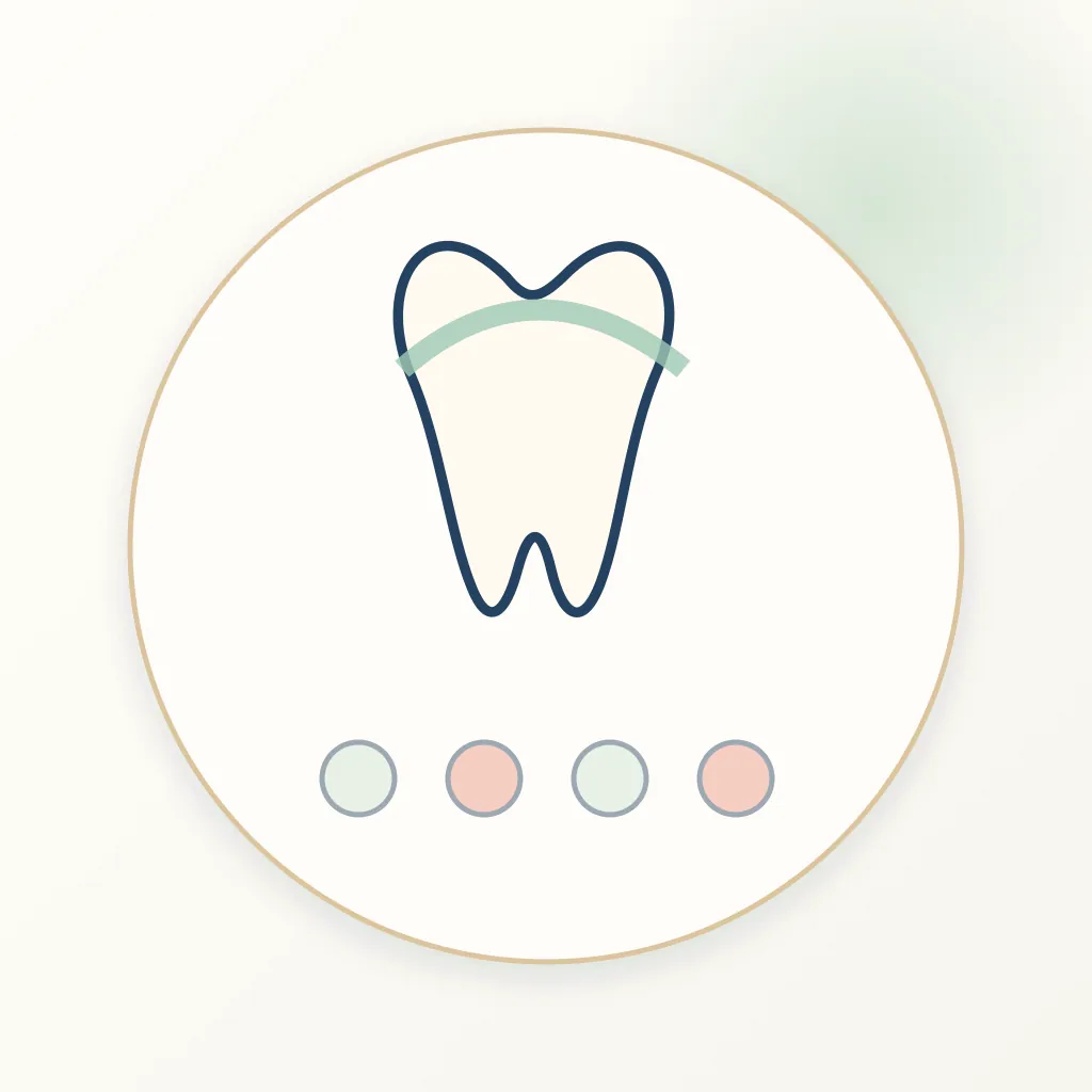 Zirconia-Reinforced Lithium Silicate dental educational illustration