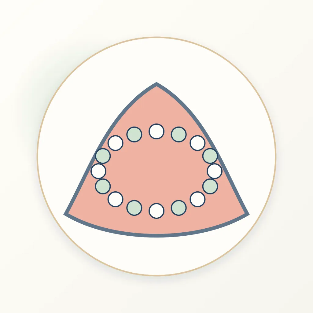 Resin-Modified Glass Ionomer dental educational illustration