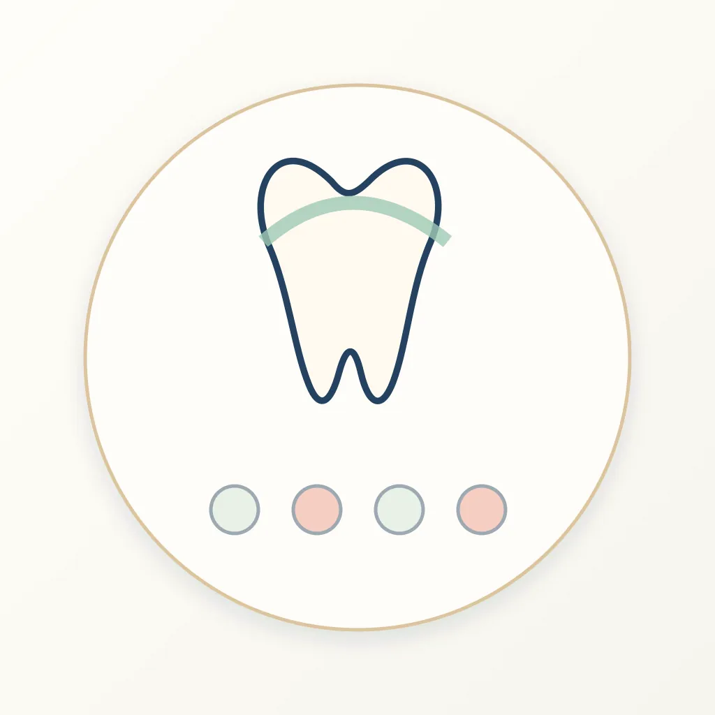 Zirconia Implants (Ceramic Fixtures) dental educational illustration