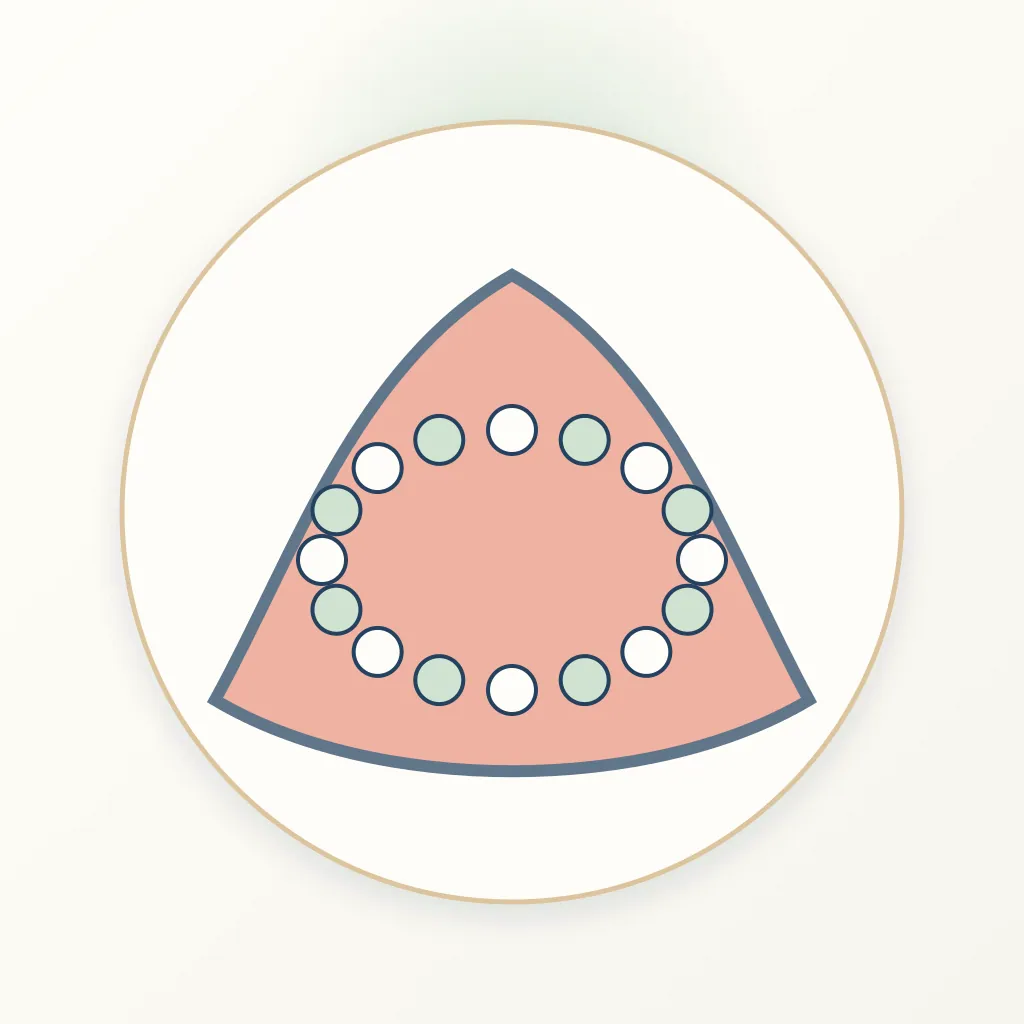 Polymethyl Methacrylate (PMMA) dental educational illustration