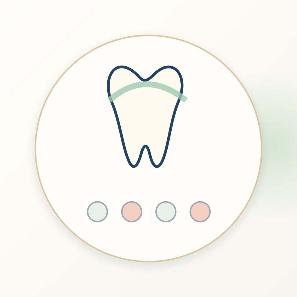 Ceramic-Polymer Network dental educational illustration