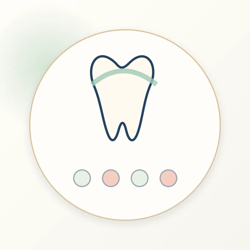 Lithium Silicate Ceramic dental educational illustration