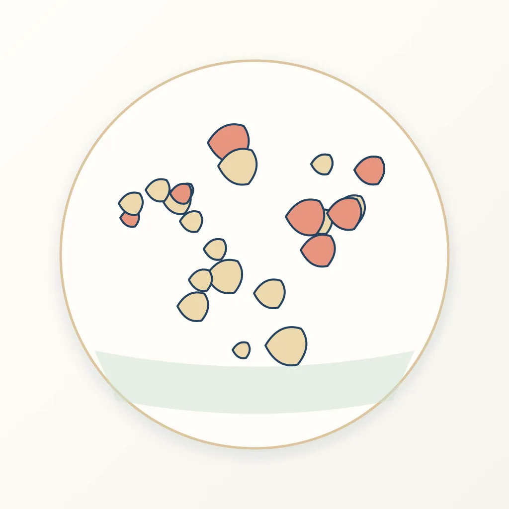 Synthetic Bone Graft dental educational illustration