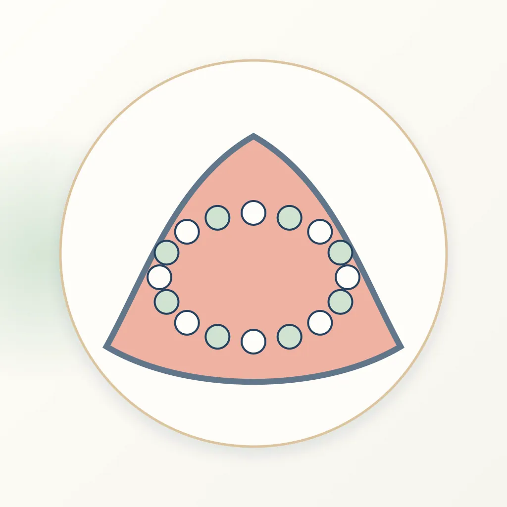 Resin Cement dental educational illustration
