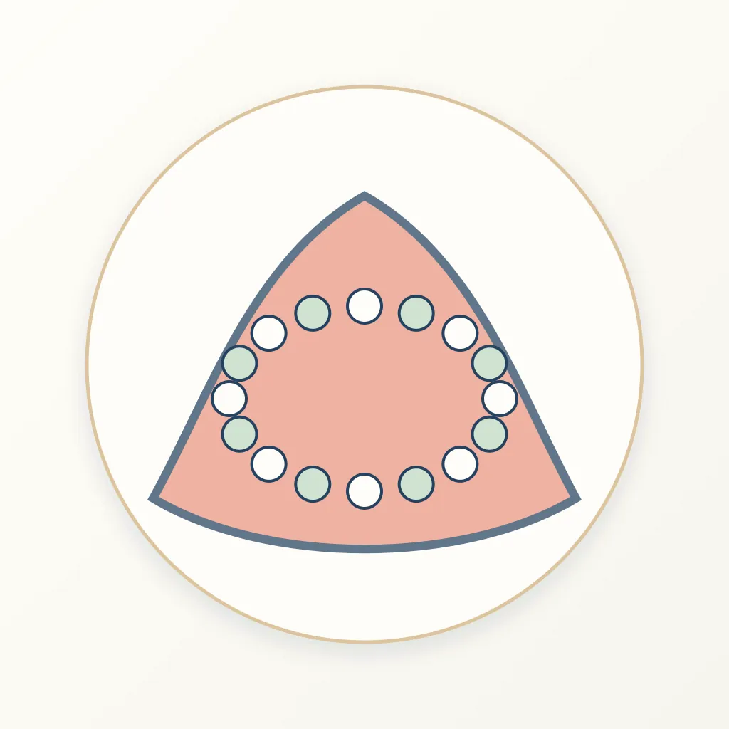 Fiber-Reinforced Composite dental educational illustration