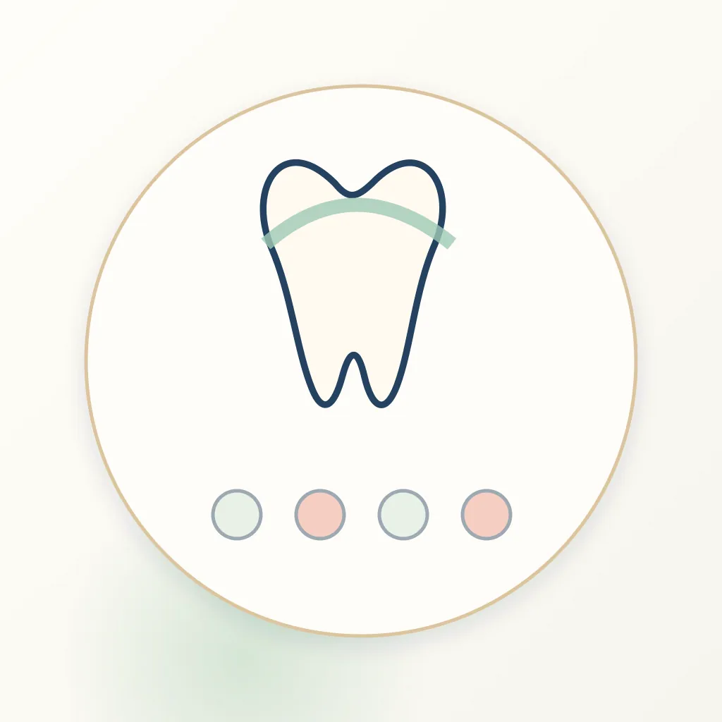 Translucent Zirconia dental educational illustration