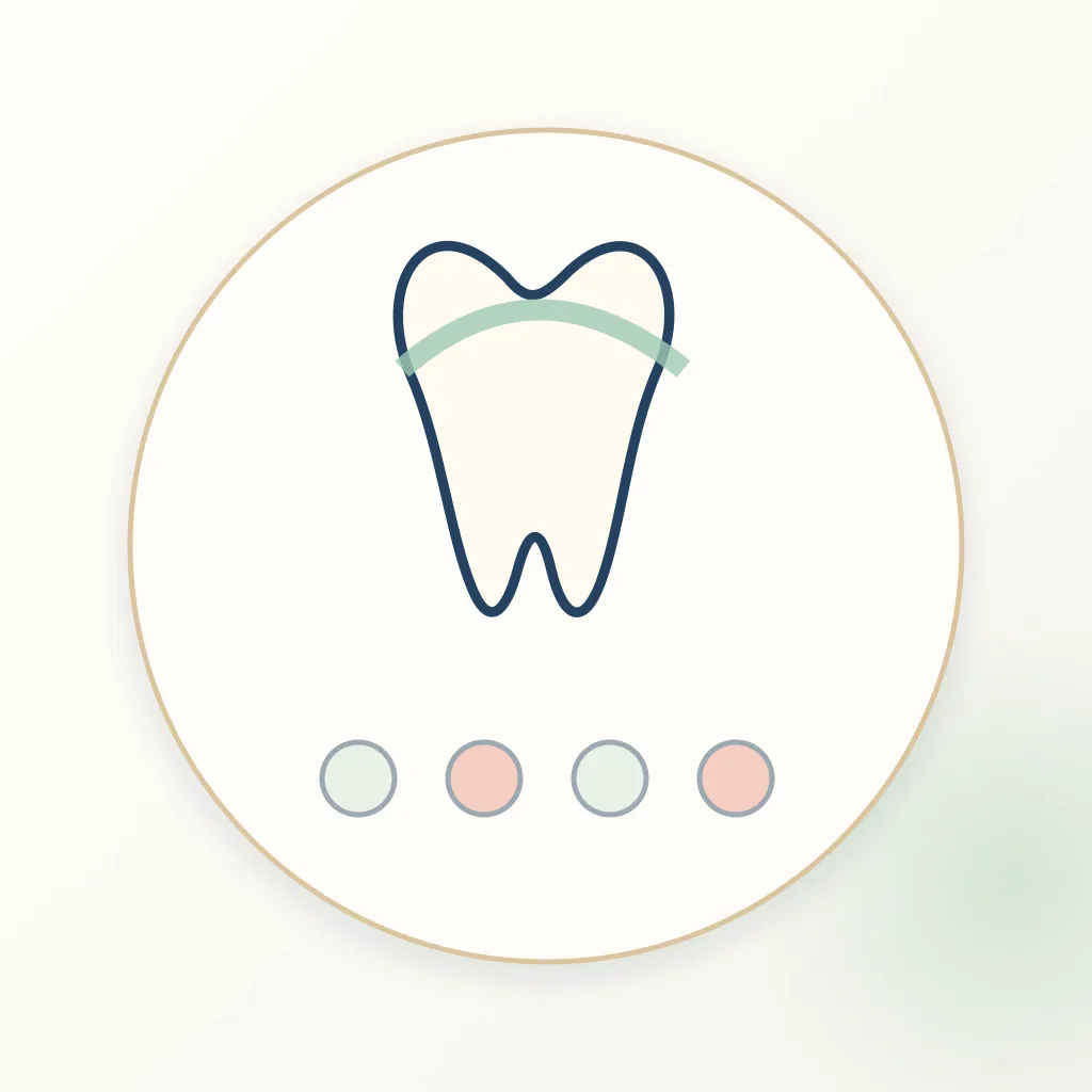 Monolithic Zirconia dental educational illustration