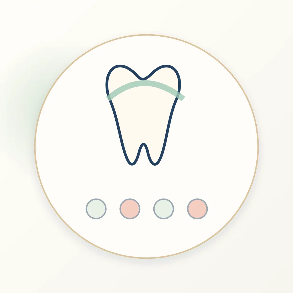 Bioceramic Sealer dental educational illustration