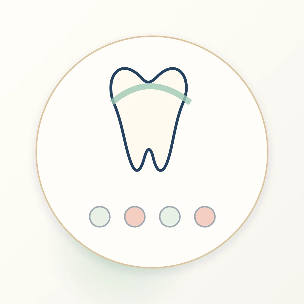 Porcelain (Feldspathic) dental educational illustration