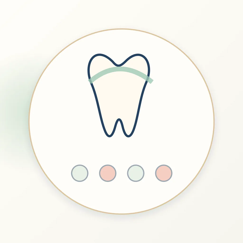 Multilayer Zirconia dental educational illustration