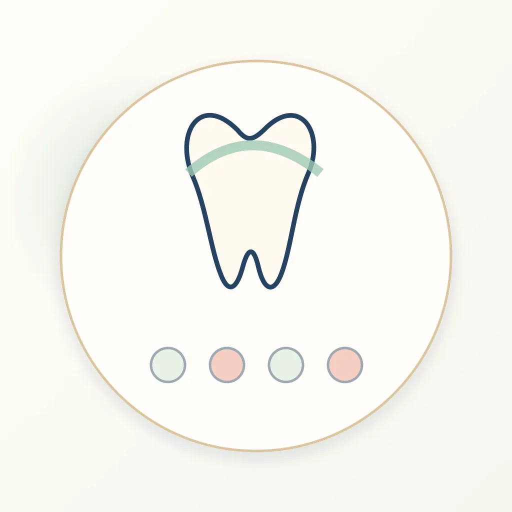 Leucite-Reinforced Ceramic dental educational illustration
