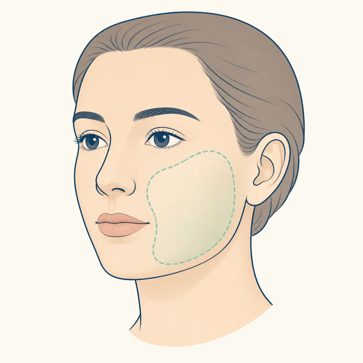 Swollen Cheek dental educational illustration