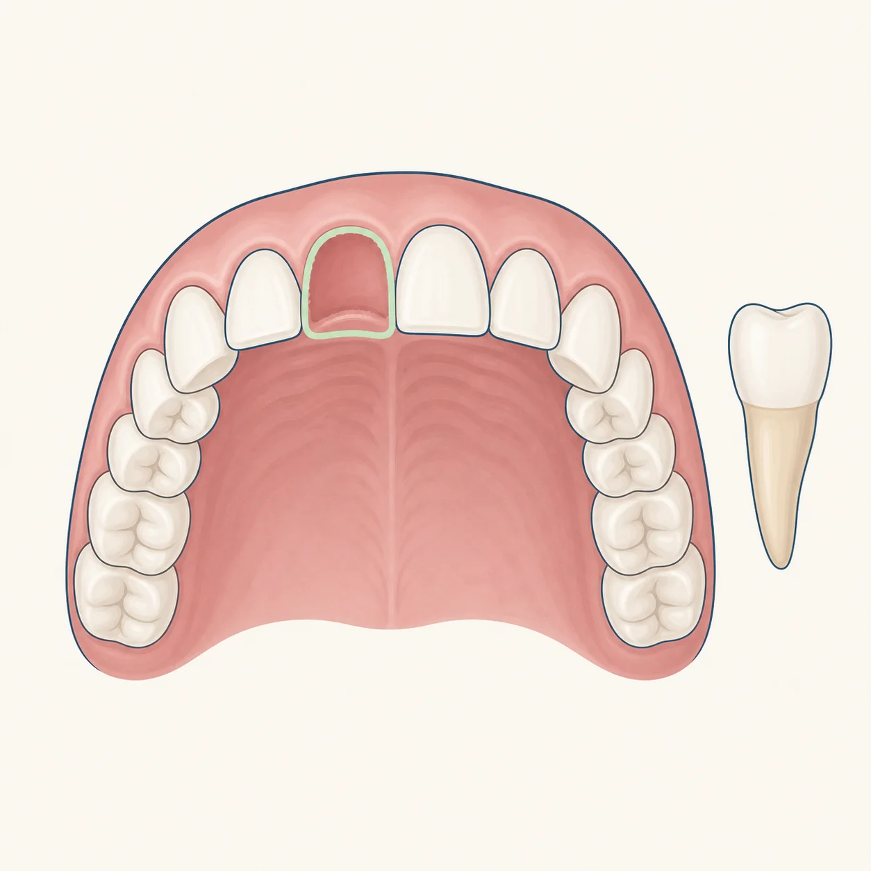 Knocked-Out Tooth dental educational illustration