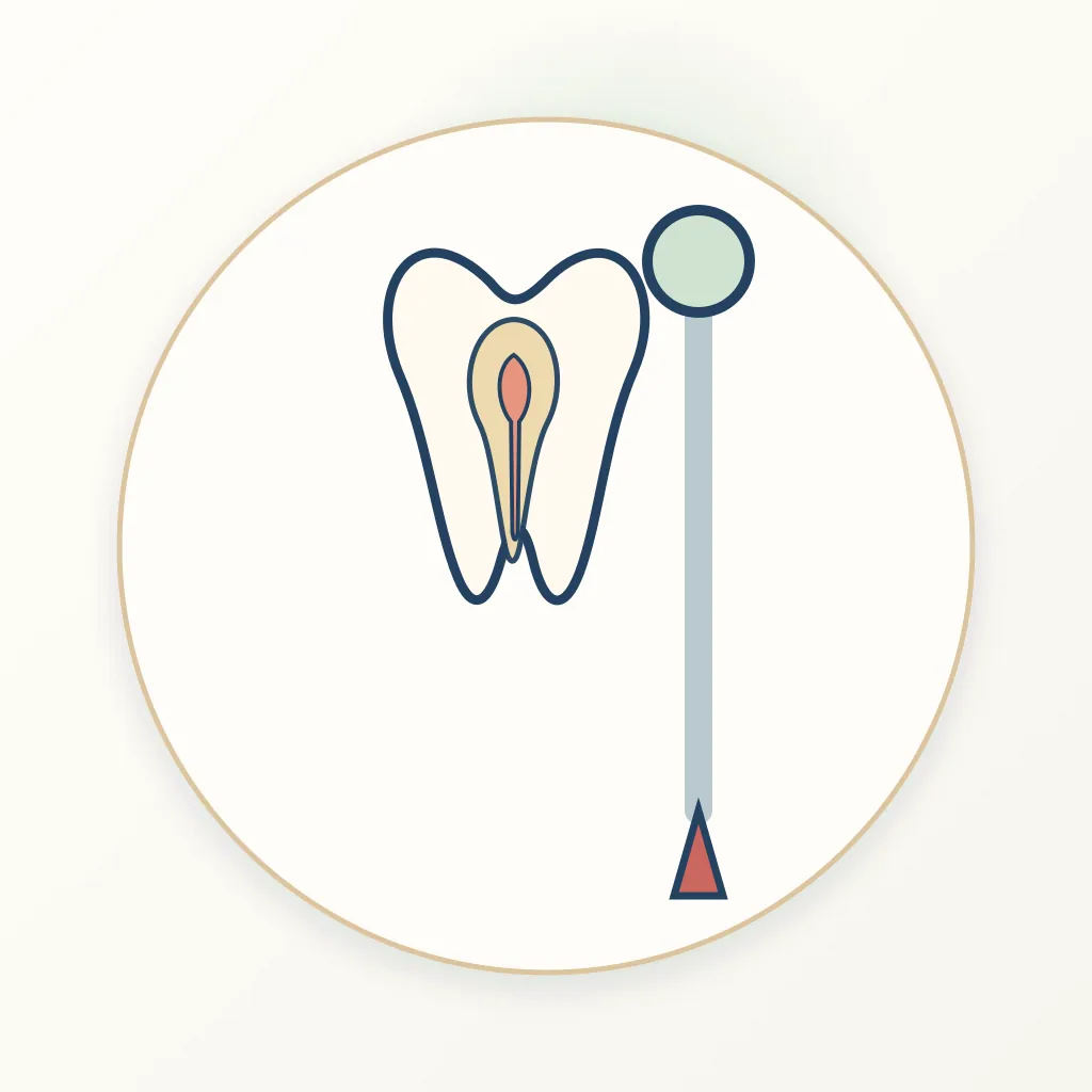 Carrier-Based Root Canal Obturation dental educational illustration
