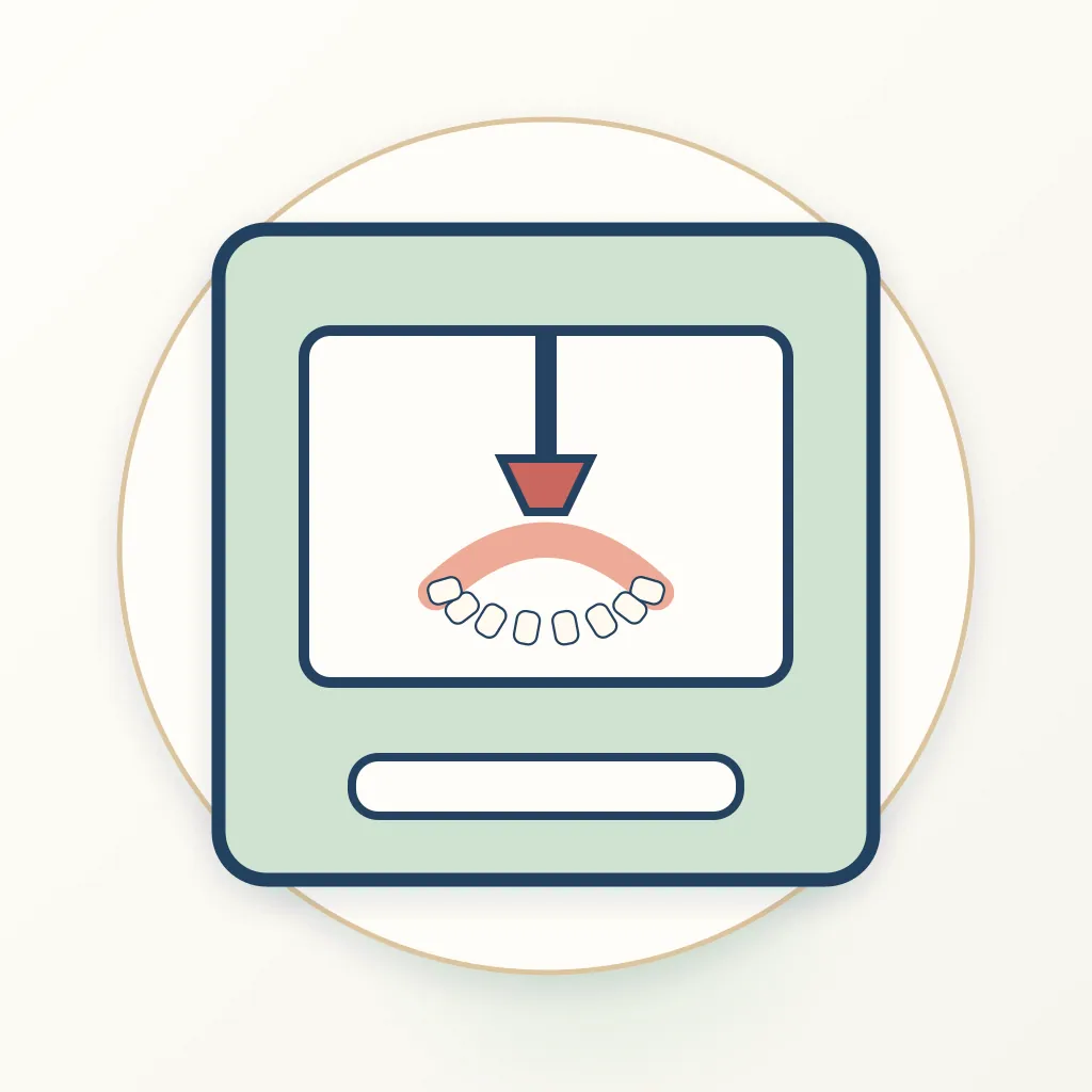 Chairside Dental Milling dental educational illustration