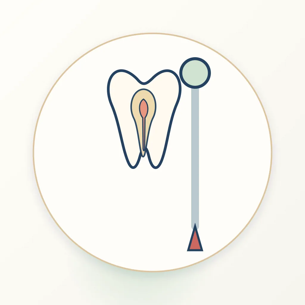 Ultrasonic Root Canal Irrigation dental educational illustration