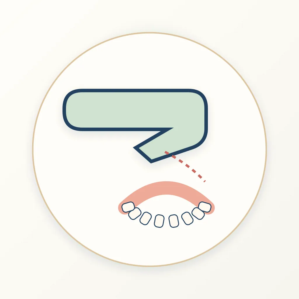 Intraoral Camera dental educational illustration