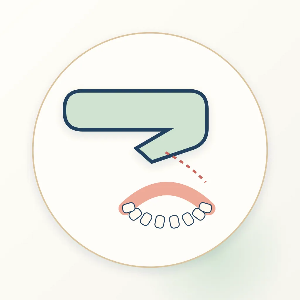 iTero Scanner dental educational illustration