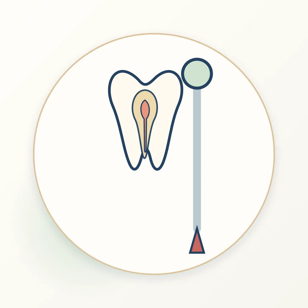 Warm Vertical Root Canal Obturation dental educational illustration