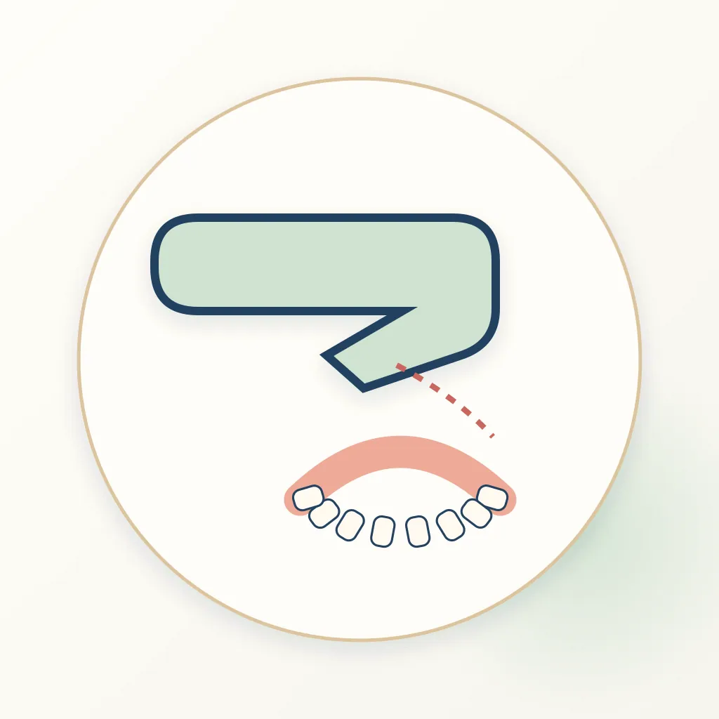 Intraoral Scanner dental educational illustration