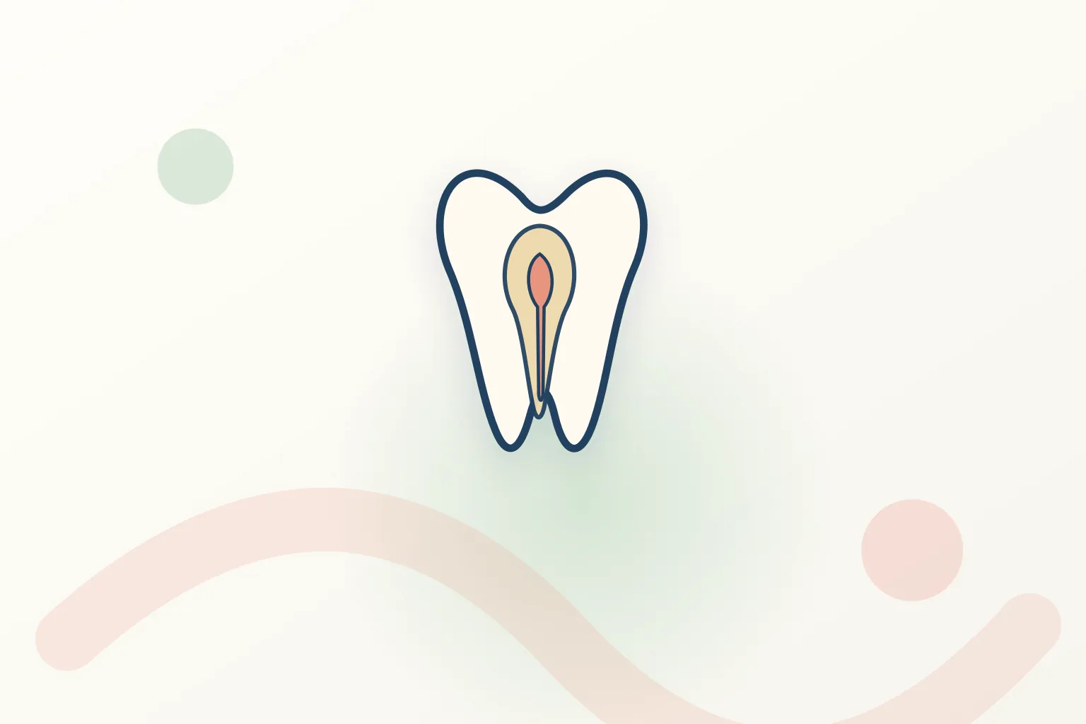 Indirect Pulp Capping dental educational illustration
