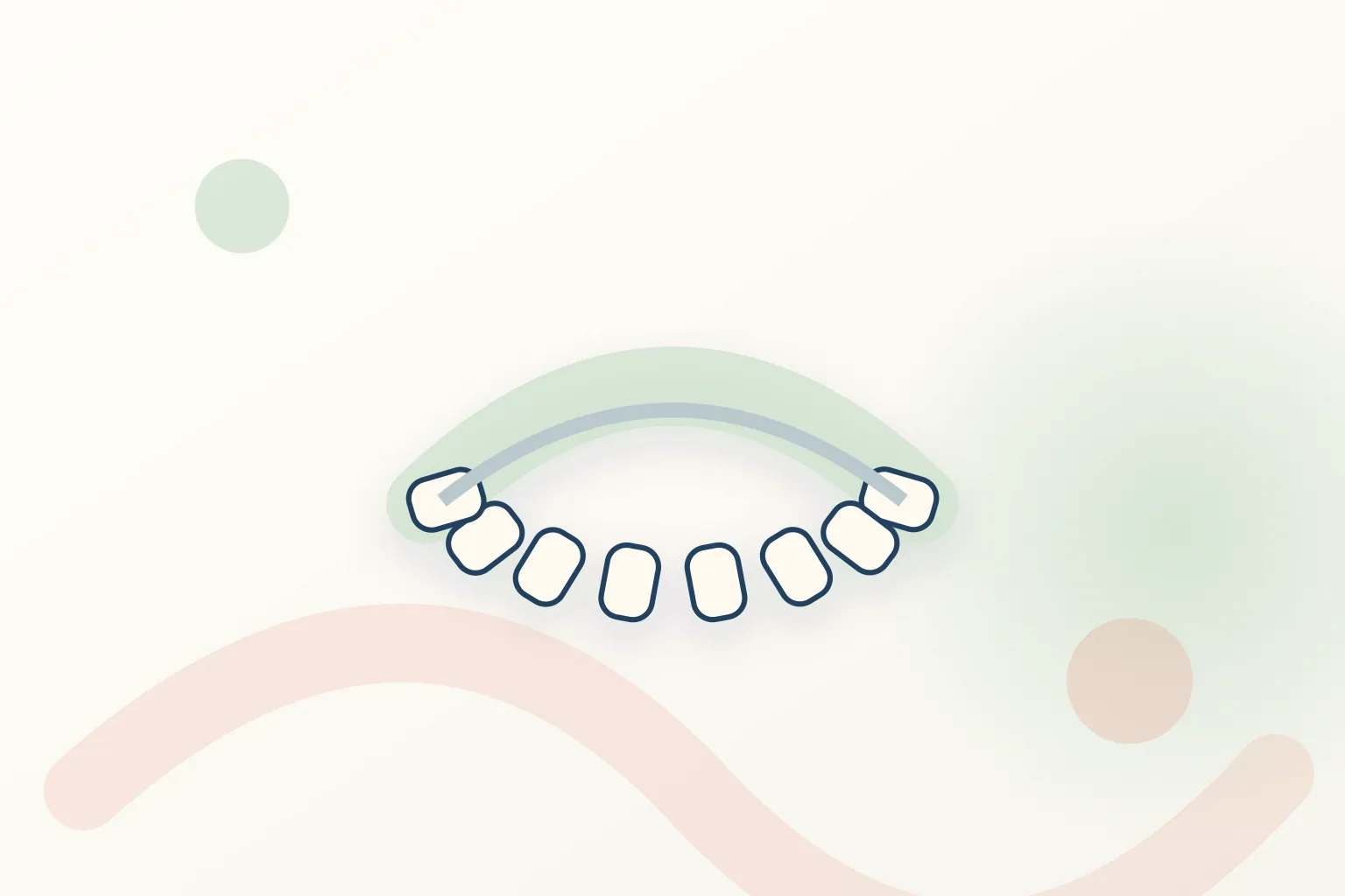 Lingual Braces dental educational illustration