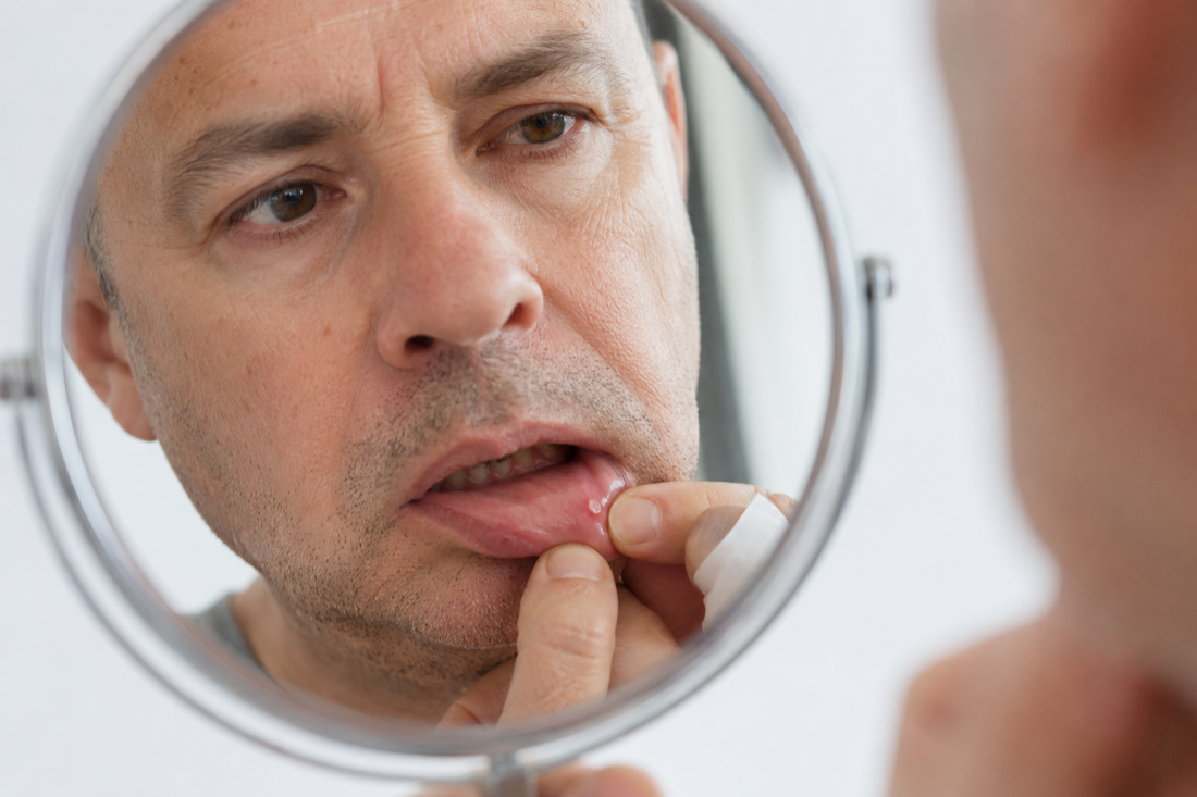 Soft Tissue Lesions & Oral Cancers