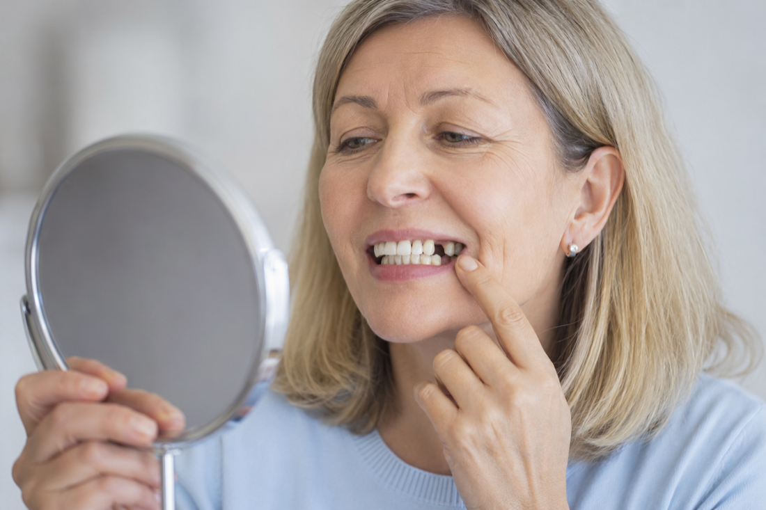 Tooth Loss & Replacement